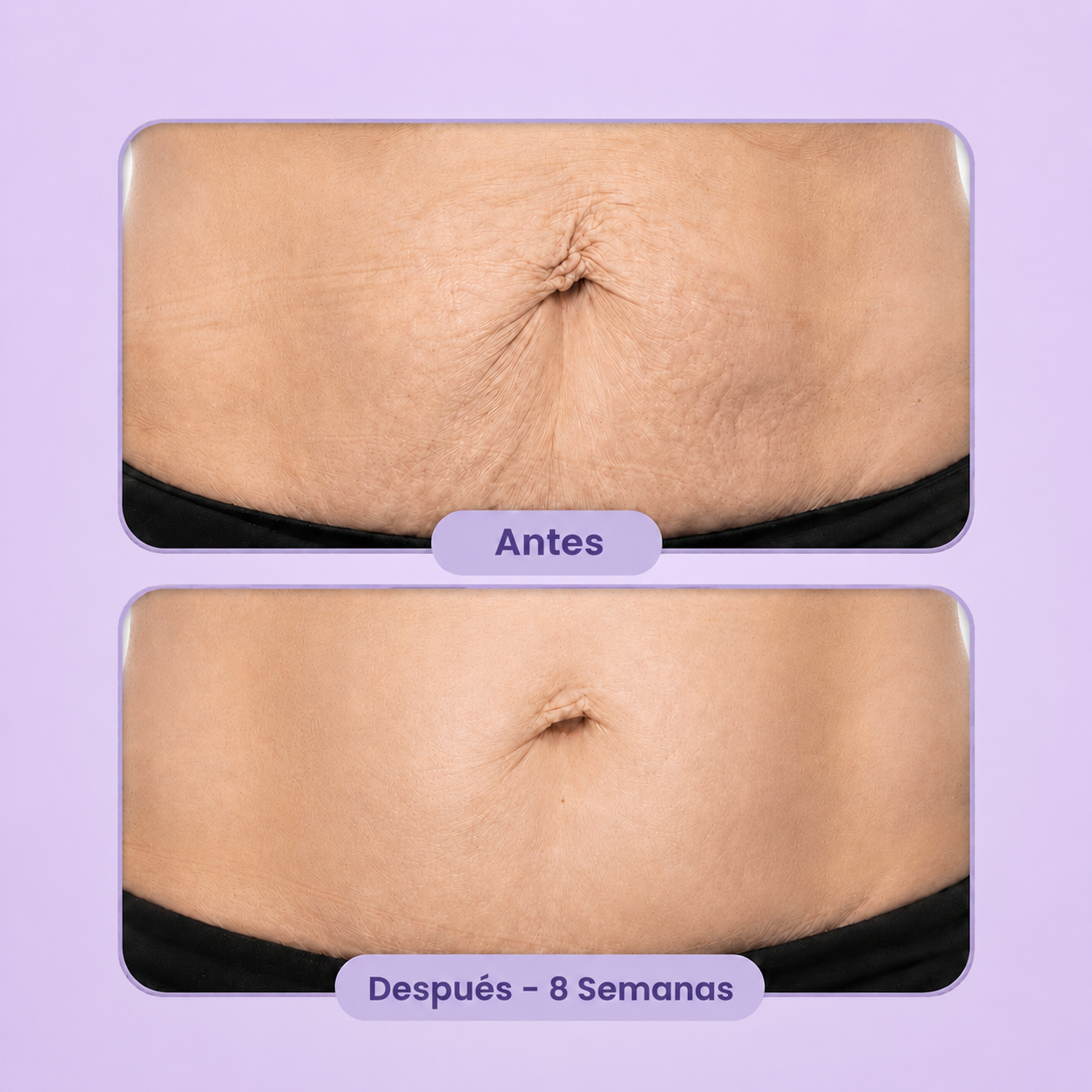 Crema Reafirmante Corporal | Resultados visibles en 30 días