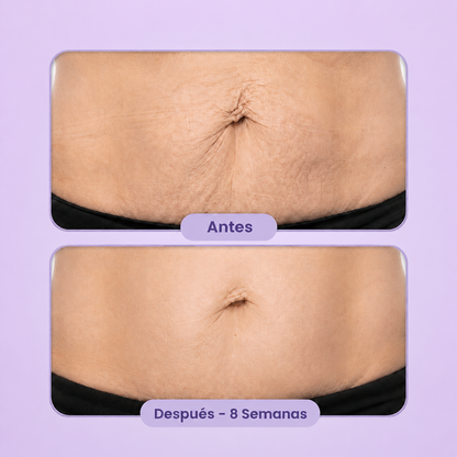 Crema Reafirmante Corporal | Resultados visibles en 30 días