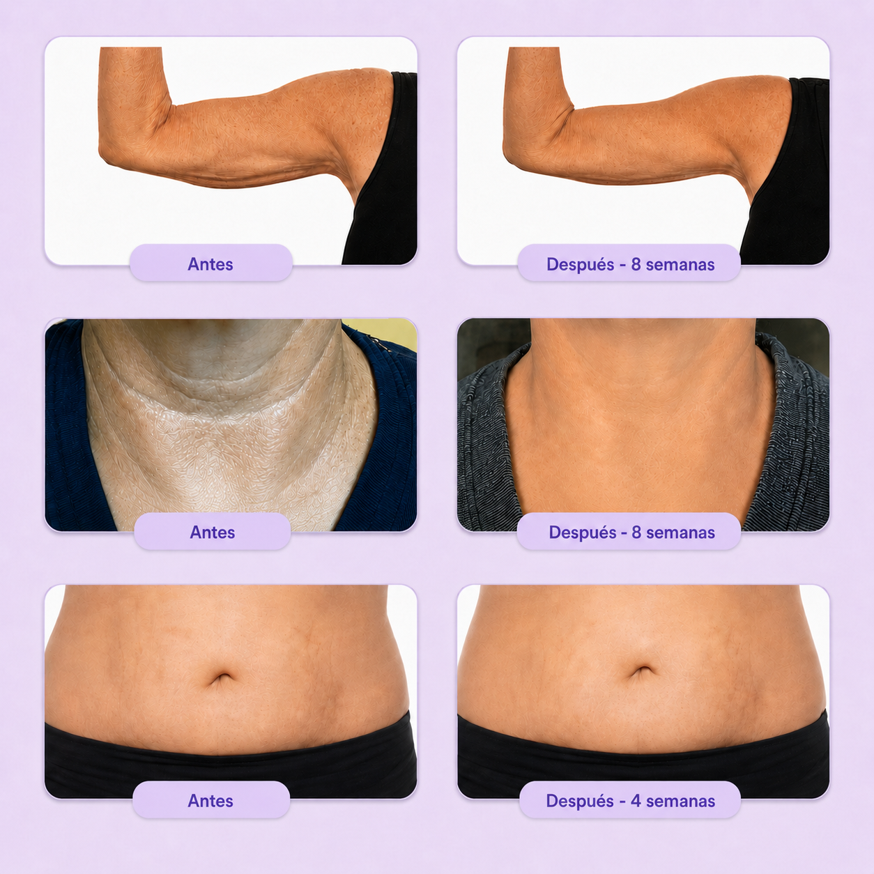 Crema Reafirmante Corporal | Resultados visibles en 30 días