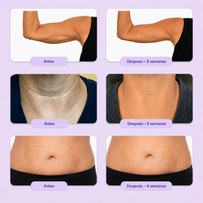 Crema Reafirmante Corporal | Resultados visibles en 30 días